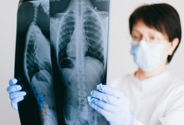 Вплив кондиціонерів на дихальні шляхи: як уникнути «кондиціонерного бронхіту» 