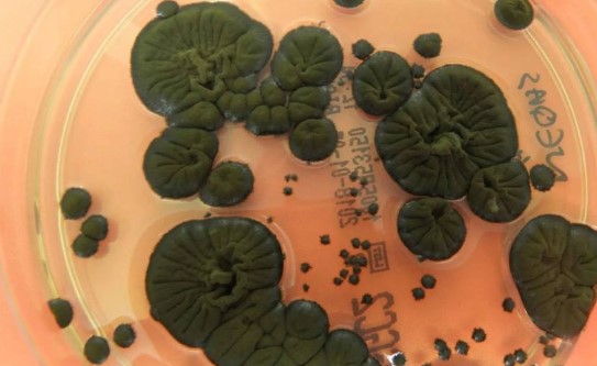 На ЧАЕС грибок «живиться» радіацією 