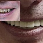 Как выбрать хорошую стоматологию в Харькове: критерии и советы 2026