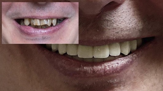 Как выбрать хорошую стоматологию в Харькове: критерии и советы 2026 